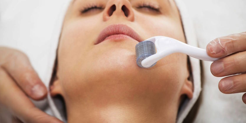 Is Microneedling Really Efficient?